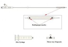 dilatatore_ureterale_palloncino